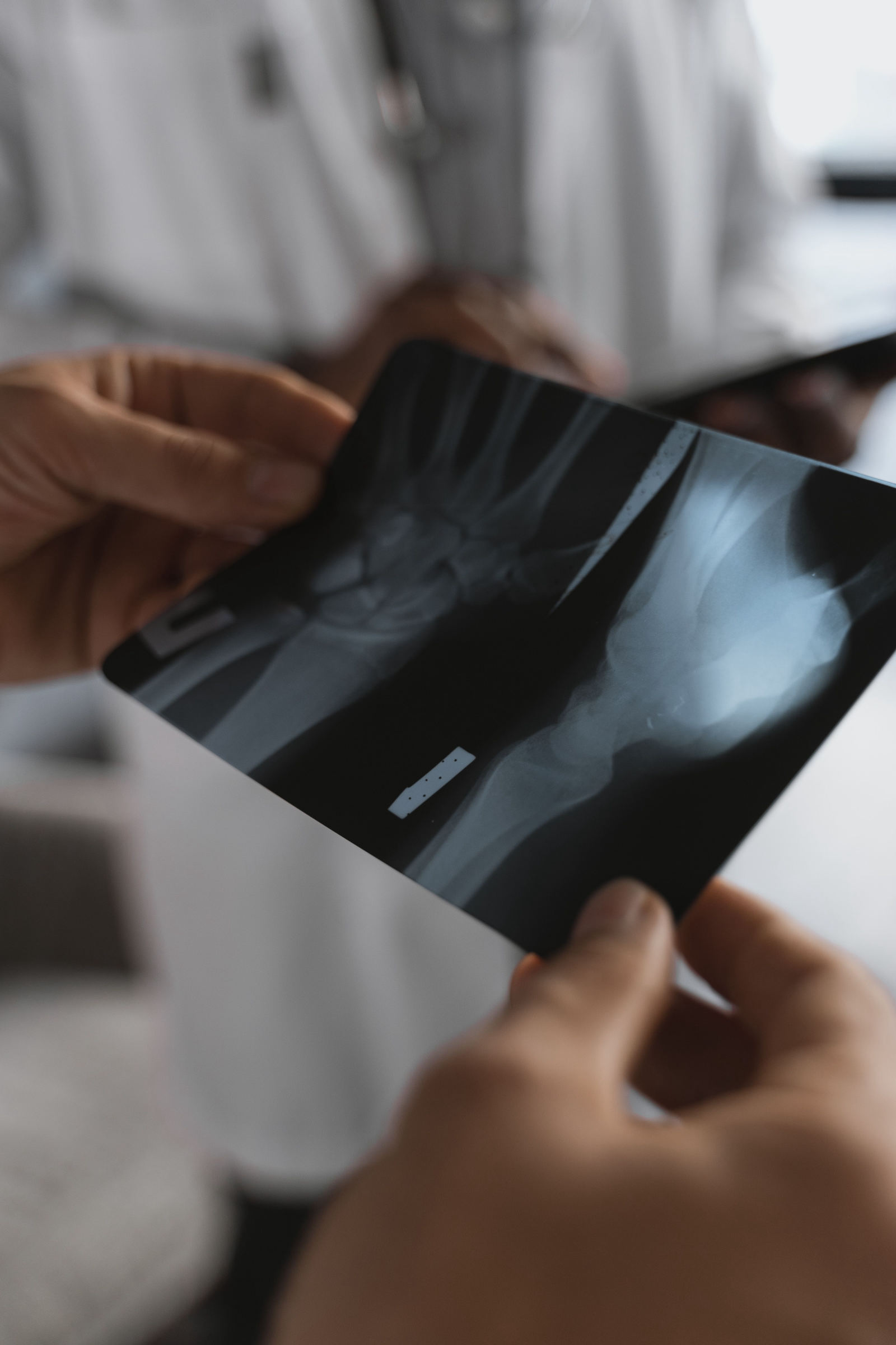Digital X-Ray at Purva Hospital